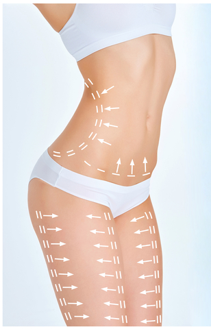 Body-contouring treatment areas illustrated across the waist, abdomen and thighs